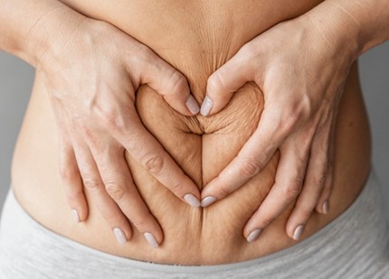 Diastasis abdominal