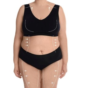 Torso de mujer antes de liposucción