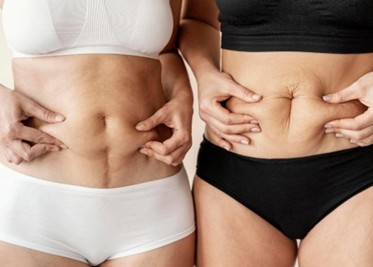 Torsos de mujeres