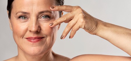 Mujer después de recuperación de una blefaroplastia