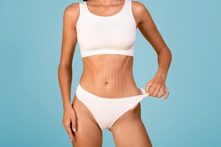 Mujer después de recuperación de una lipoabdominoplastia
